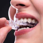 Aligner